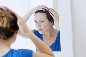 female hair loss