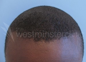 Afro3Male_After