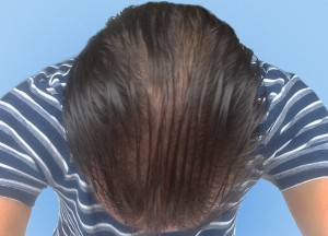 before wet hair loss