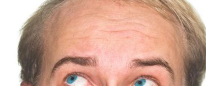 Hair transplant clinic london -westminster clinic