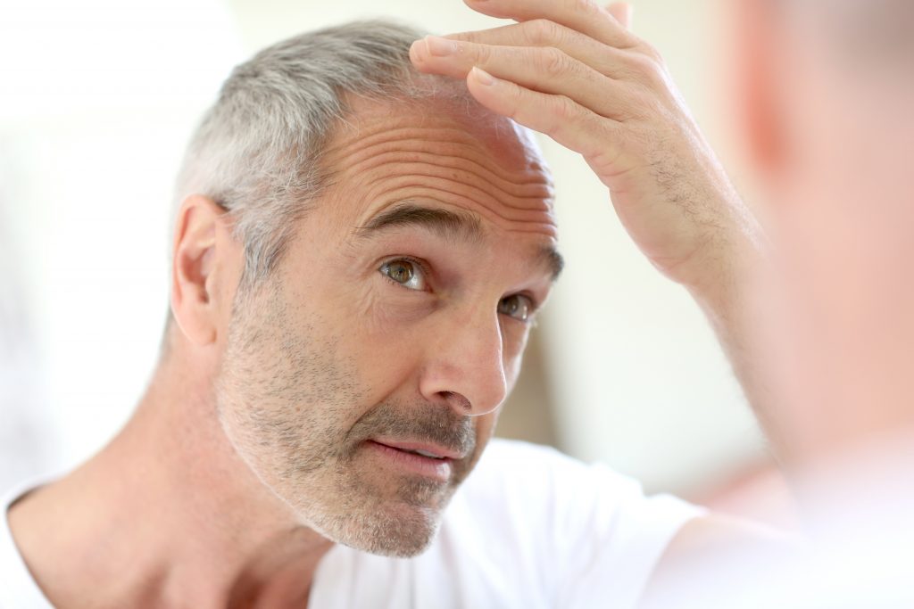 middle aged man hair transplant