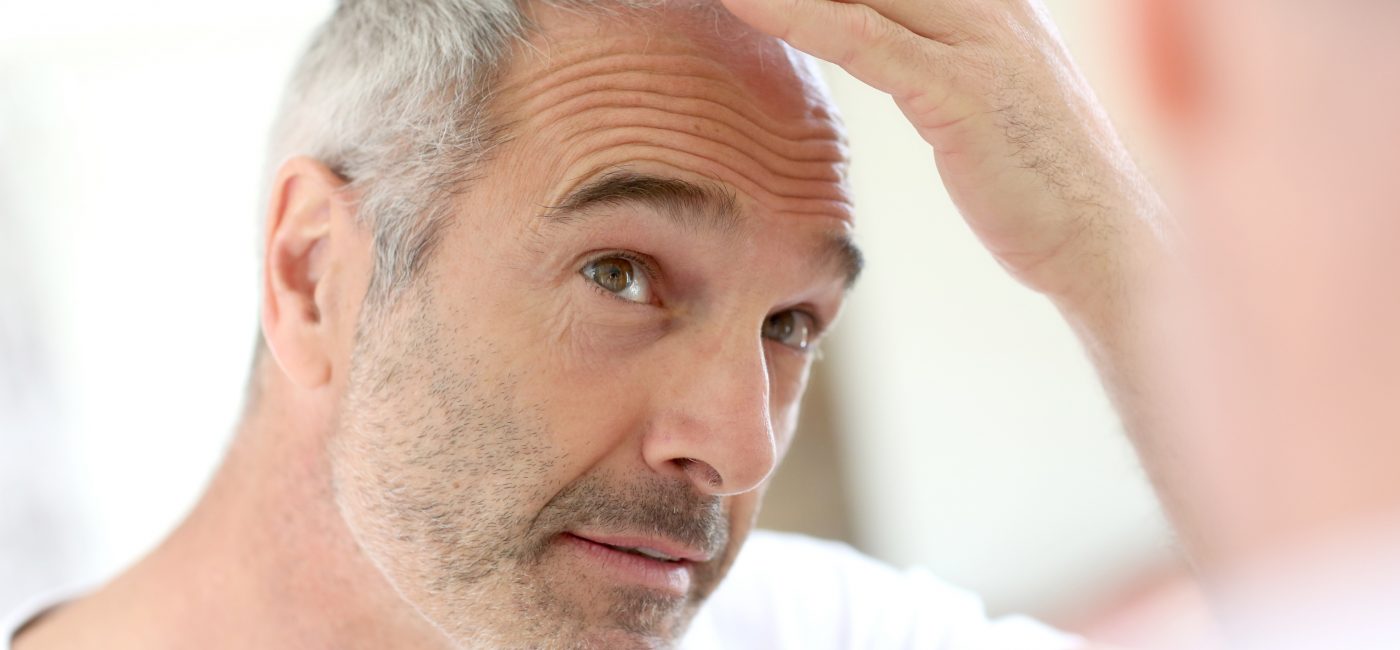 middle aged man hair transplant