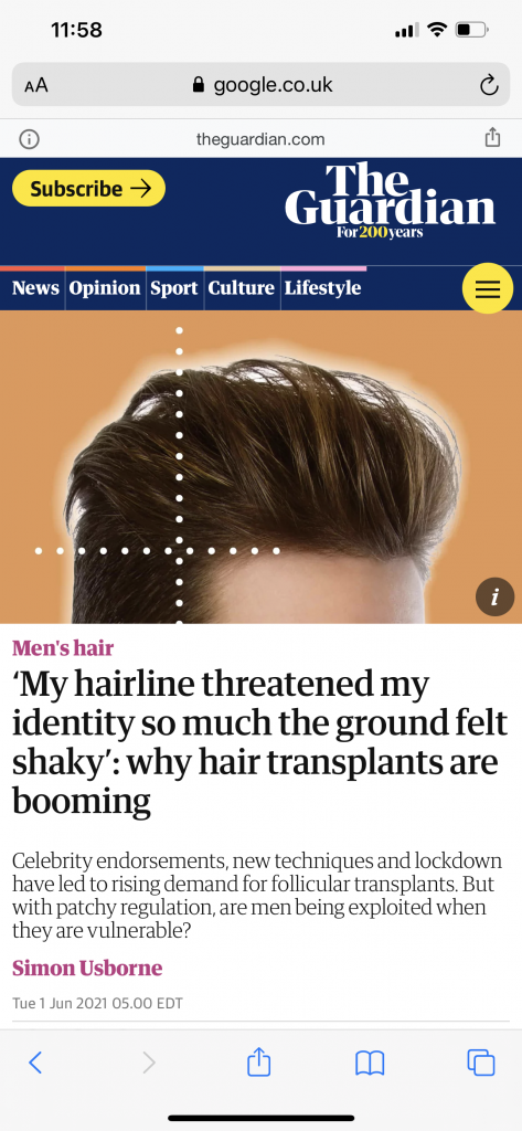 Hair transplant news